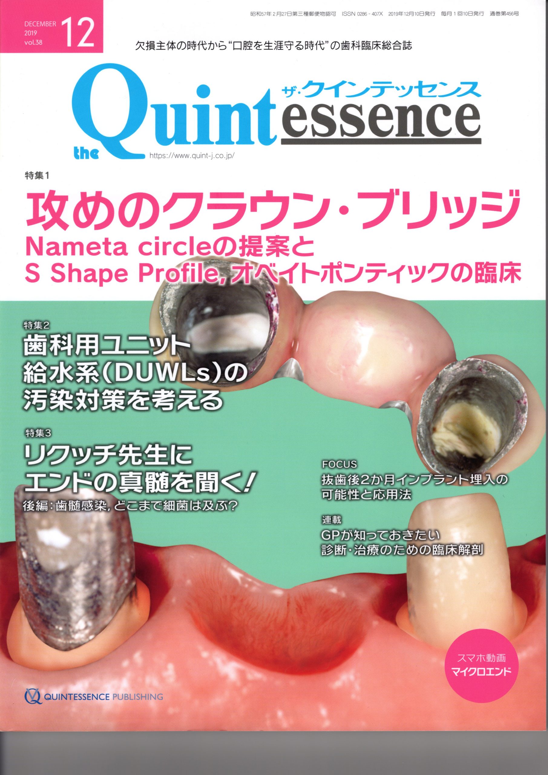 The Quintessence 12月号エキシマ光機能化システム掲載 | 株式会社エキシマ